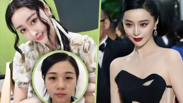 ১২ কোটি খরচে অভিনেত্রীর মতো চেহারা করে বিপদে তরুণী!